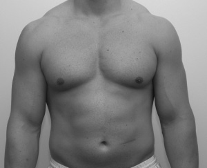 ethan-front-after1.tif