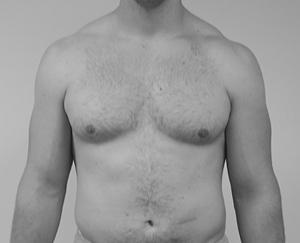 ethan-front-before1.tif